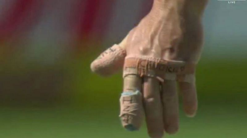 Protective tapes on David Warner&#039;s fingers