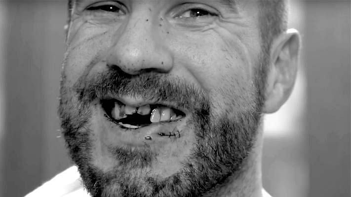 Cesaro might have messed up teeth, but he&#039;s still a consummate professional
