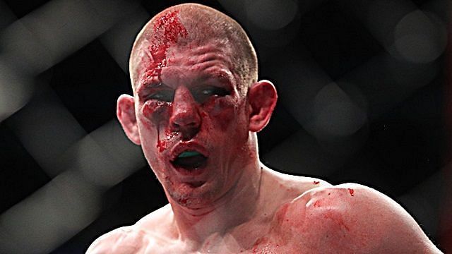 It&#039;s probably time for Joe Lauzon to retire