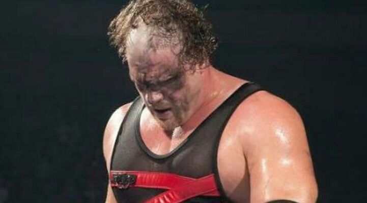 Undertaker scarred Kane&#039;s face
