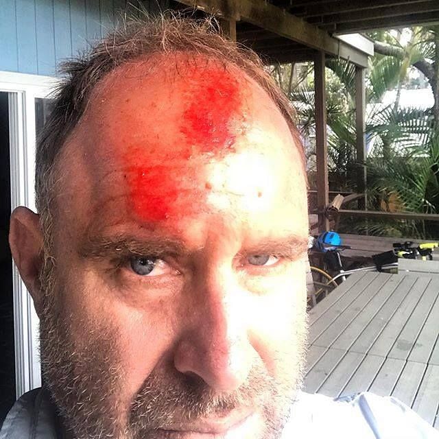 Former Australian cricketer Mathew Hayden suffers a head injury