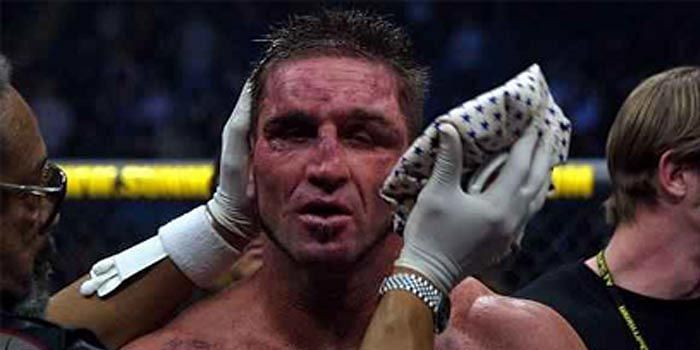 Ken Shamrock:&Acirc;&nbsp;Tito Ortiz made a right mess of his face at UFC 40