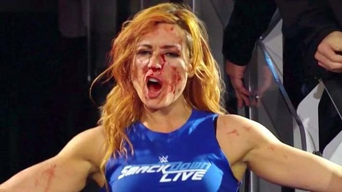 Opinion: Why WWE Should Have Becky Lynch Return At The Royal Rumble