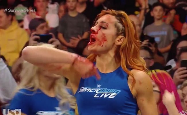 becky lynch bloody nose shirt