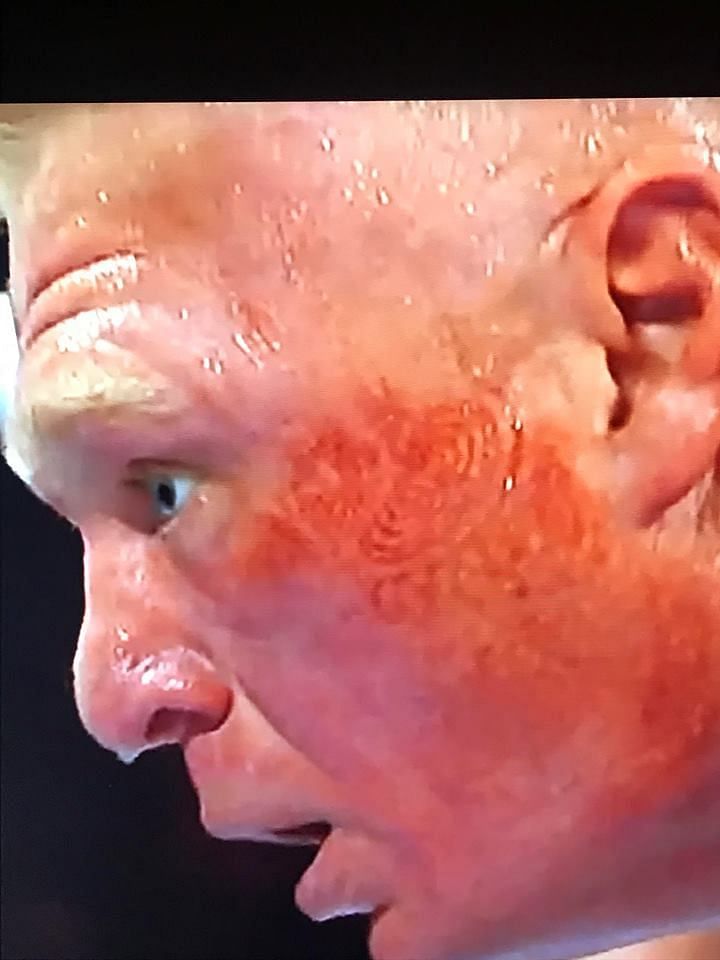 Brock Lesnar&#039;s face after Daniel Bryan had finished kicking him 