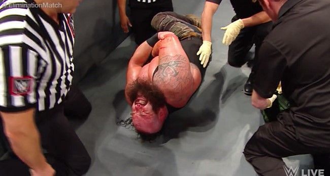 The WWE Universe was left stunned at the sight of a bloody Braun Strowman writhing in pain