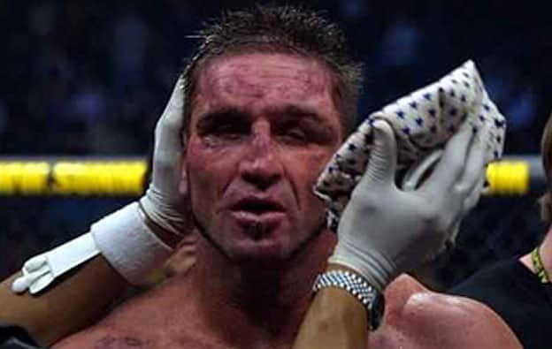 Ken Shamrock: A beaten man after the main event