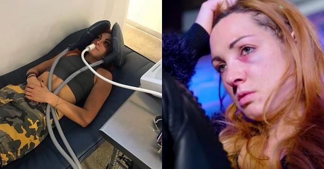 WWE Rumor Mill: Disappointing update on Becky Lynch's immediate future