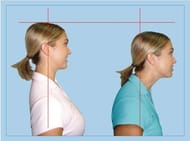 It's about time that you take notice and correct the forward neck posture