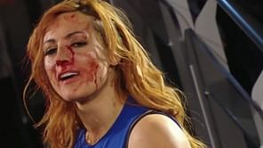 WWE न्यूज: बैकी लिंच ने अपने खून का बदला लिया