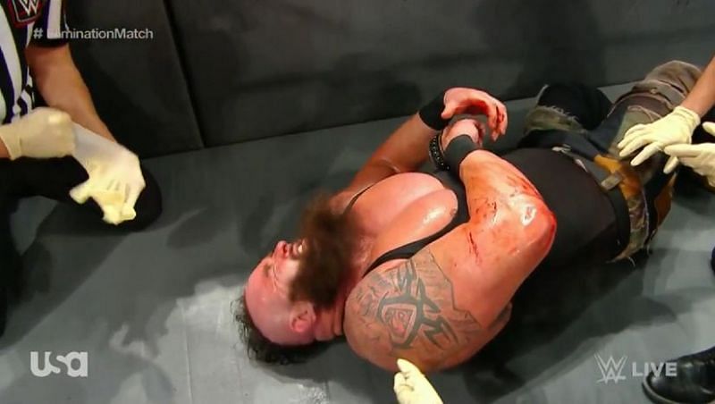 Did Braun Strowman&#039;s injuries play a role in him being removed from The Universal title picture?