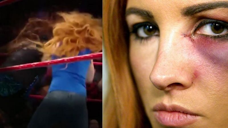 Nia Jax injured Becky Lynch on the WWE RAW ahead of Survivor Series