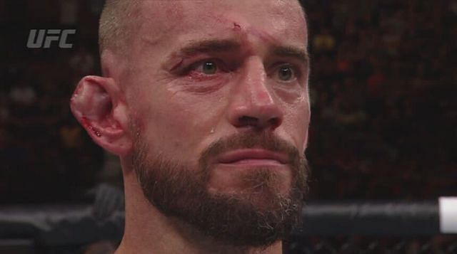 CM Punk after his quick UFC loss.