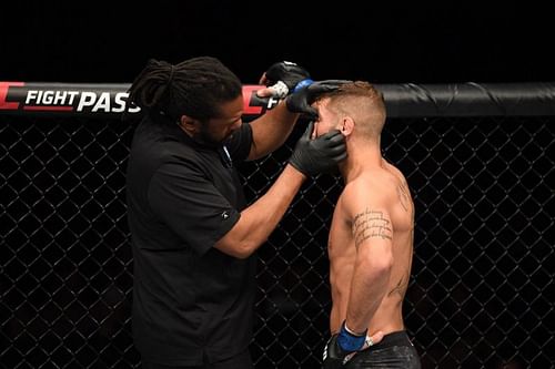 Jeremy Stephens has his eye checked out