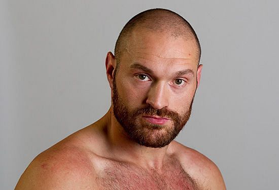 Tyson Fury WWE | News, Rumors, Photos & More| Sportskeeda WWE