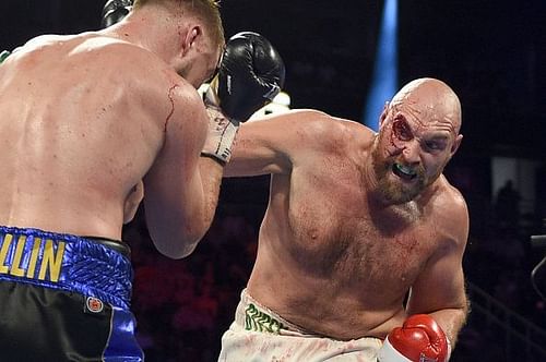 Tyson Fury v Otto Wallin