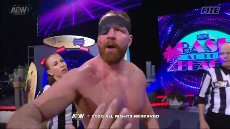 Jon Moxley can still face PAC next with even with one eye