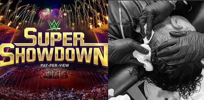 WWE Super ShowDown 2020 से पहले लगी पूर्व चैंपियन को गंभीर चोट, सिर पर आए 9 टांके