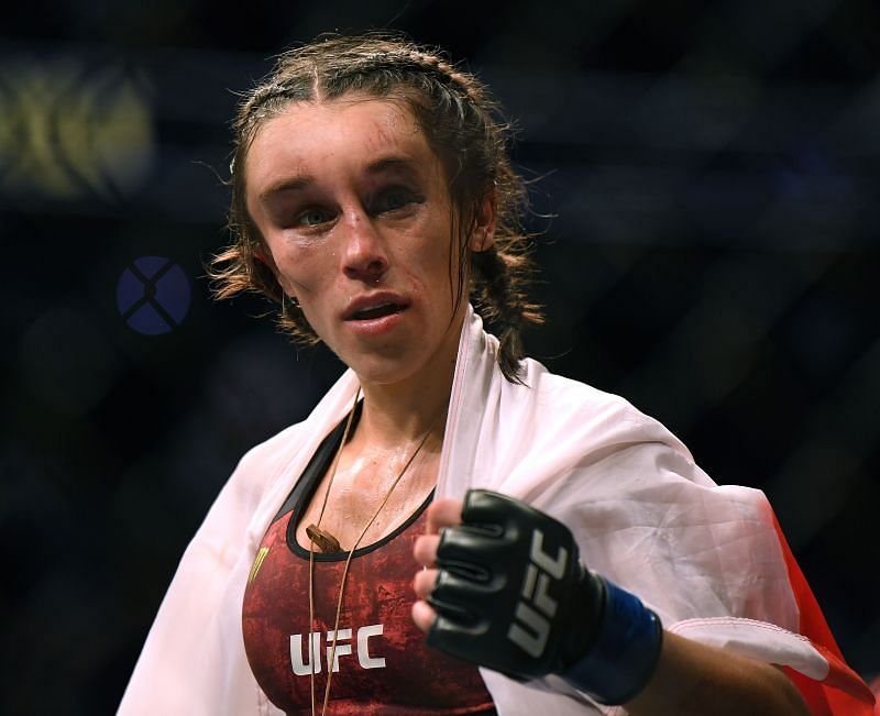 Joanna got a nasty hematoma on her head as a token from her fight against Weili Zhang.