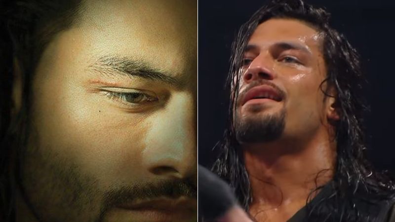 Roman Reigns tried to hide the cut on WWE RAW