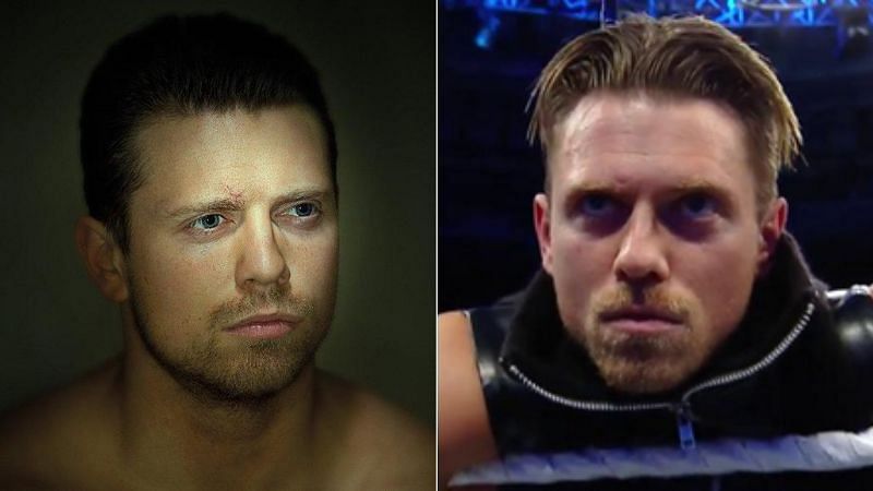 The Miz competed in two WWE matches one day after sustaining his scar