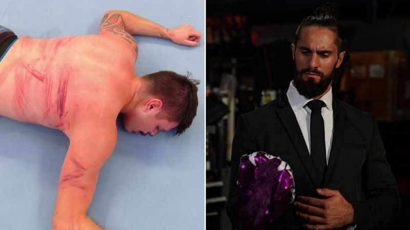 What condition will Dominik be in after the beating he suffered at the hands of Seth Rollins?