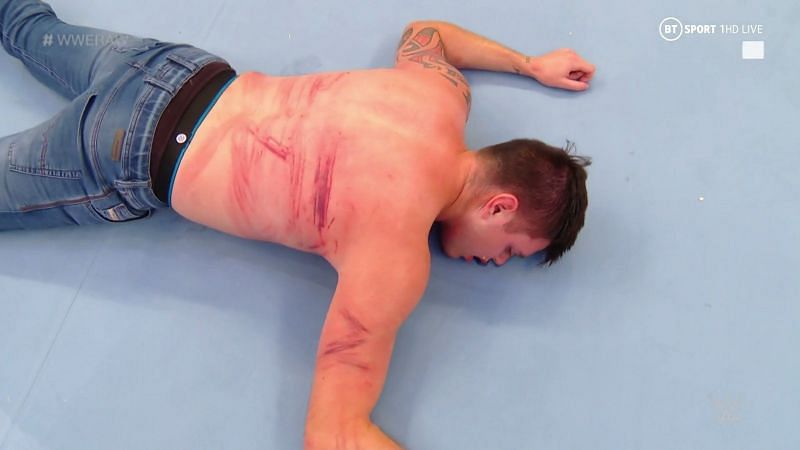 Dominick took a brutal beating on RAW