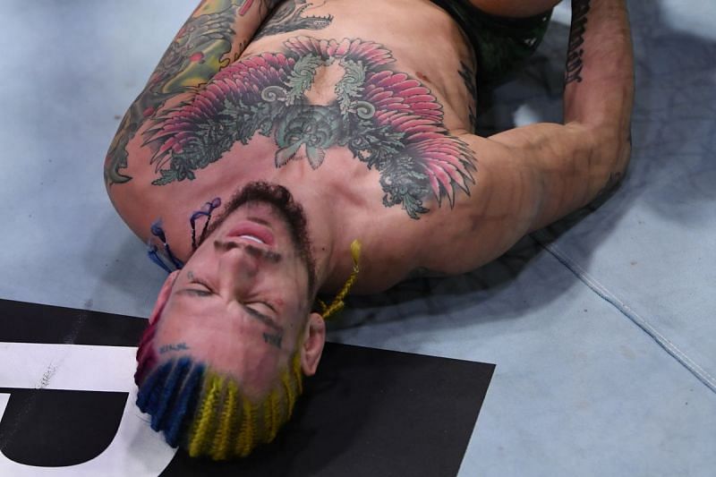 Sean O&#039;Malley after his injury at UFC 252