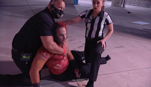 Hardy is possibly in serious condition (Pic Source: AEW)