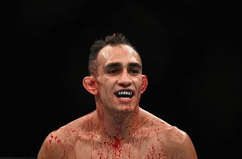 Tony Ferguson looks on while competing against Anthony Pettis