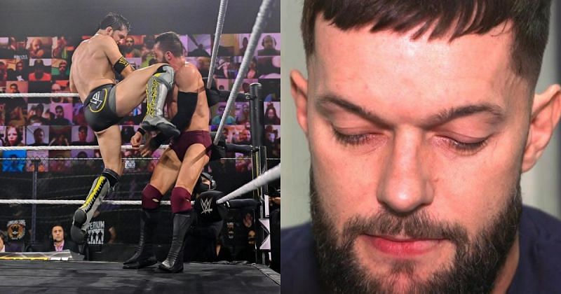 Finn Balor posts a graphic X-Ray image of his broken jaw, big update on ...