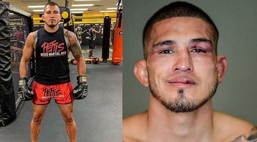 Anthony Pettis