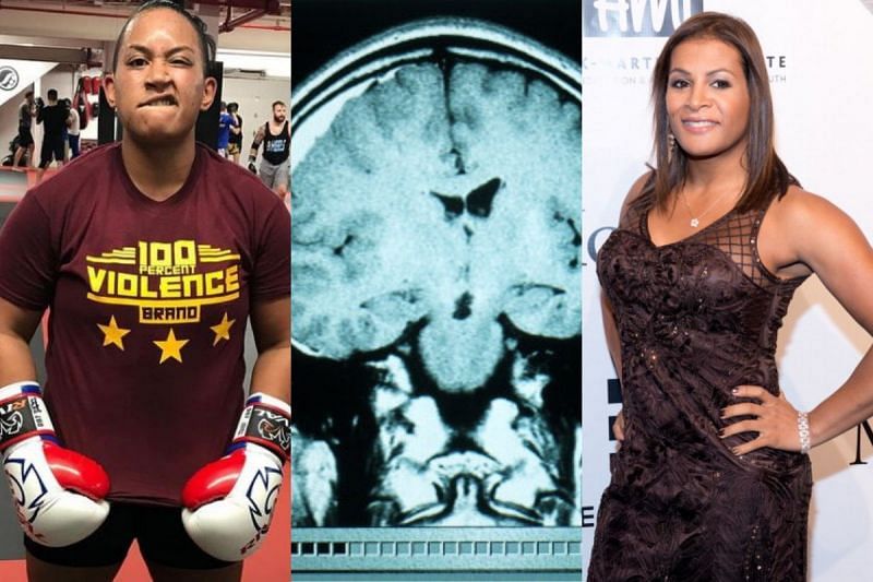 Fallon Fox -- A Former Man -- Sparks An MMA Transgender