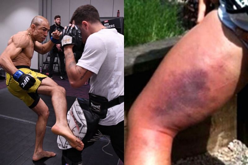 Who is the most devastating leg kicker in UFC history?