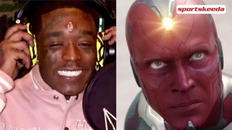 I Could Die Lil Uzi Shares Picture Of Forehead Bleeding After 24 Million Pink Diamond Experiment Backfires
