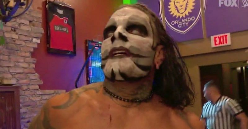 Jeff Hardy had a brief character change in the bar fight against Sheamus.