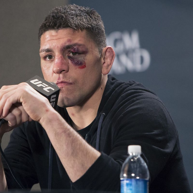 Nick Diaz&#039;s body has been through years of fighting