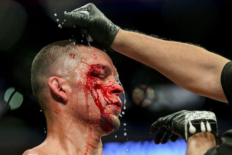 5 reasons why Nate Diaz will dominate Jake Paul in a boxing match.