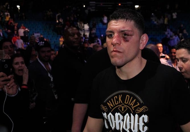Watch: Nick Diaz reacts to fan asking him about his UFC return
