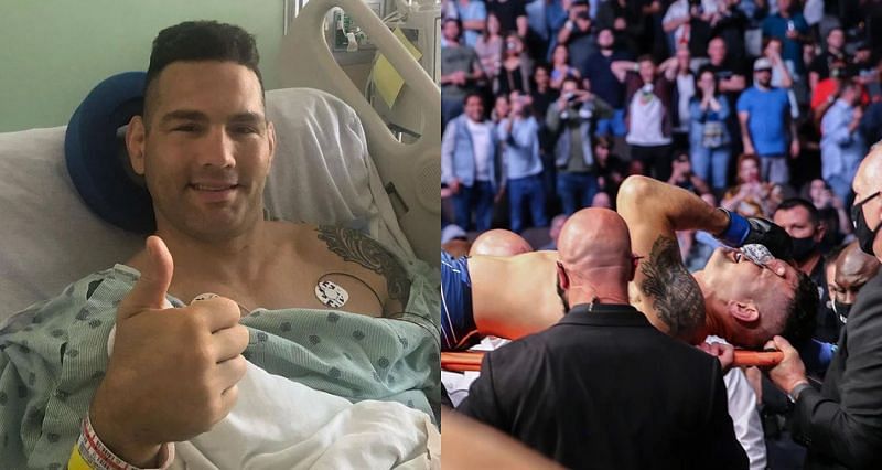 Chris Weidman suffered a gruesome leg injury at UFC 261