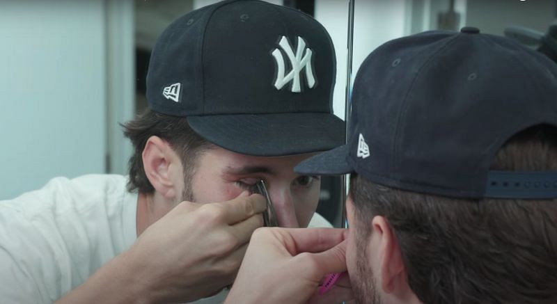 “will I Lose My Eye” Jeff Wittek’s Series Shows His Eye Injury Getting Worse As David Dobrik