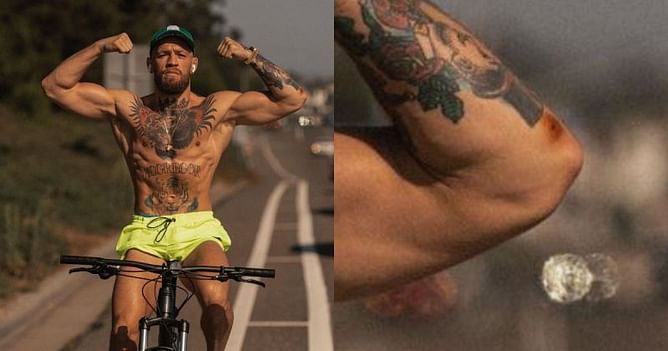 Conor McGregor picture fuels speculation that he may have a staph infection ahead of UFC 264