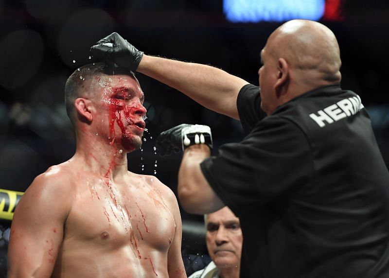 Nate Diaz at UFC 244