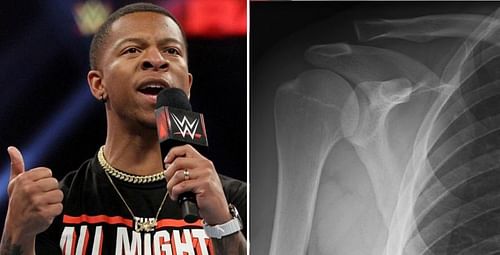 AC joint separation: The injury that led to Lio Rush announcing his retirement from pro-wrestling