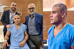 Most hilarious social media reactions to Paulo Costa's hair transplant