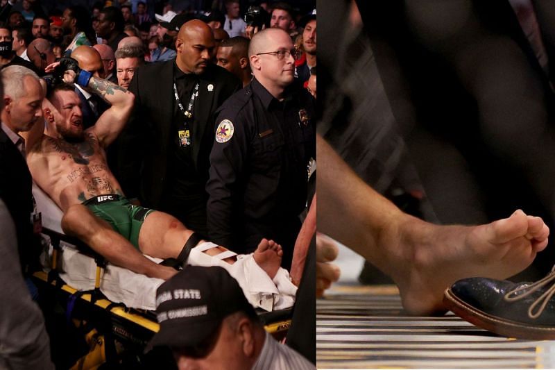 Dr. David Abbasi opines on Conor McGregor&#039;s leg break