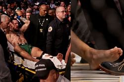 UFC ringside physician shoots down notion that chronic arthritis could have resulted in Conor McGregor's nasty leg break at UFC 264