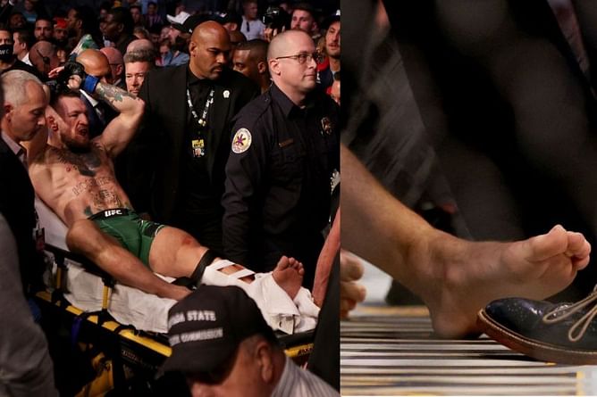 UFC ringside physician shoots down notion that chronic arthritis could have resulted in Conor McGregor's nasty leg break at UFC 264