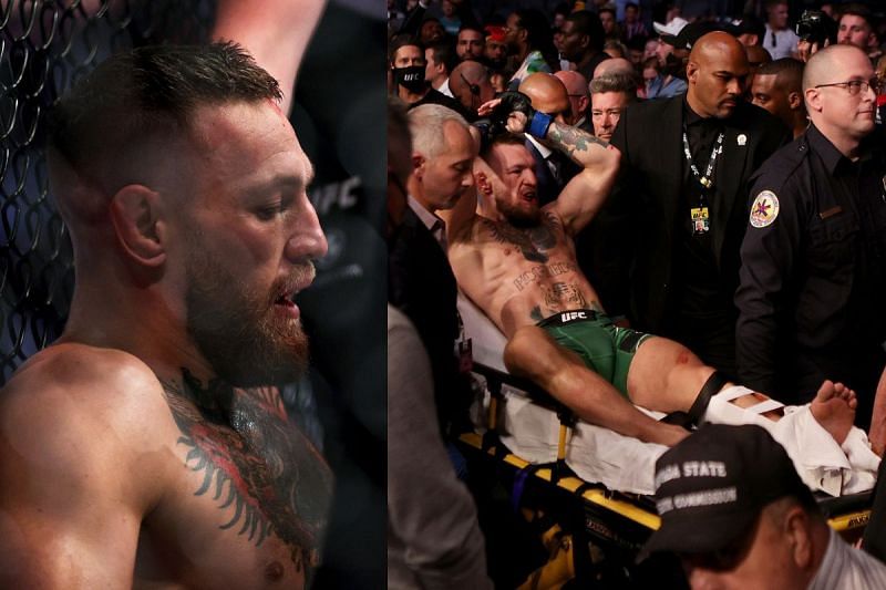 Conor McGregor with his broken leg at UFC 264