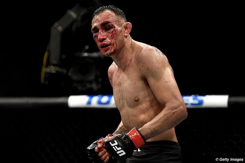 Tony Ferguson is arguably one of the toughest fighters in the UFC today